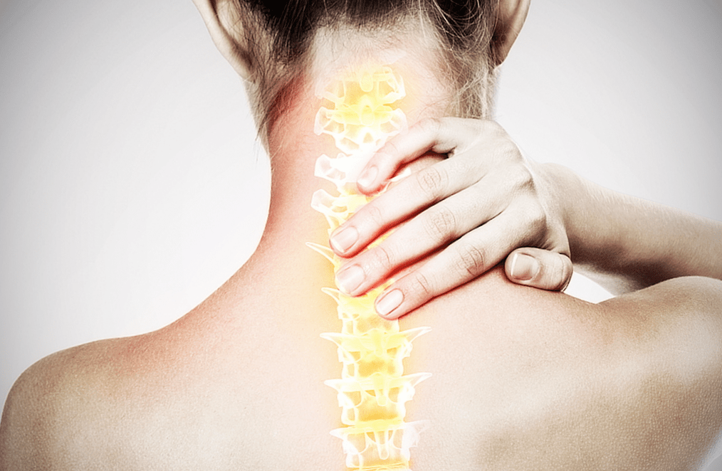spinal Osteochondrose